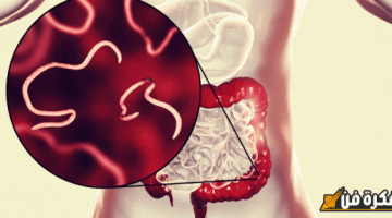 الديدان الدبوسية عند النساء: الأسباب، الأعراض، وطرق العلاج الفعالة التي يجب معرفتها!