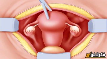 كم يستمر نزول الدم بعد عملية تنظيف الرحم؟ اكتشف الآثار والتوقعات لضمان صحتك وراحتك بعد العملية!