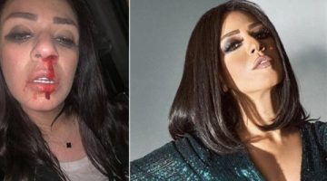 الفنانة شاهيناز توضح حقيقة طلاقها واعتداء زوجها عليها