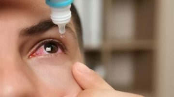 أحمي نفسك منه.. أعراض الرمد الربيعي وطرق الوقاية