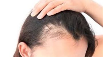 أفضل زيت لإنبات الشعر وتكثيفه من أسرار الطبيعة