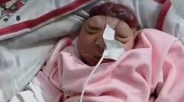 نطالب بالتحقيق في نوعية الأسلحة التي يستخدمها الاحتلال وتسببت في ولادة أطفال مشوهين