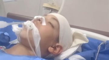 تعرض طفل للسحل على يد 3 طلاب بكفرالشيخ ووالده يستغيث: عاوز حق ابني